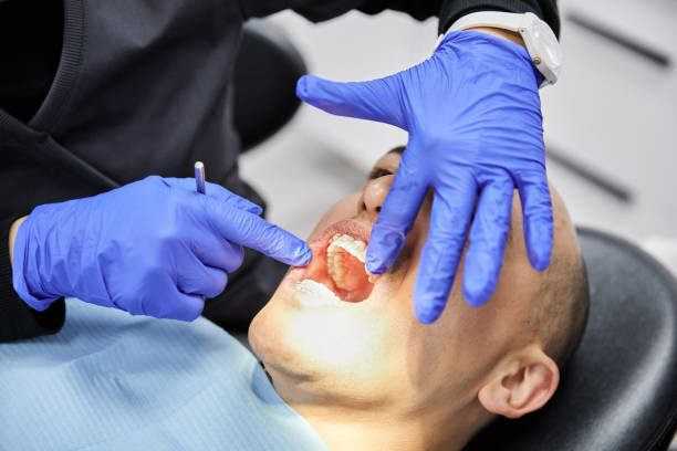 Best Knocked-Out Tooth (Avulsed Tooth) Treatment in Algoma, WI
